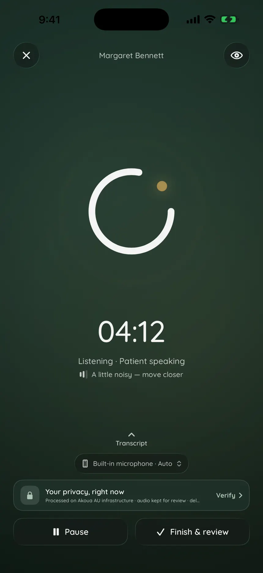 Akoua on iPhone during a live consult: the recording screen with consented capture running